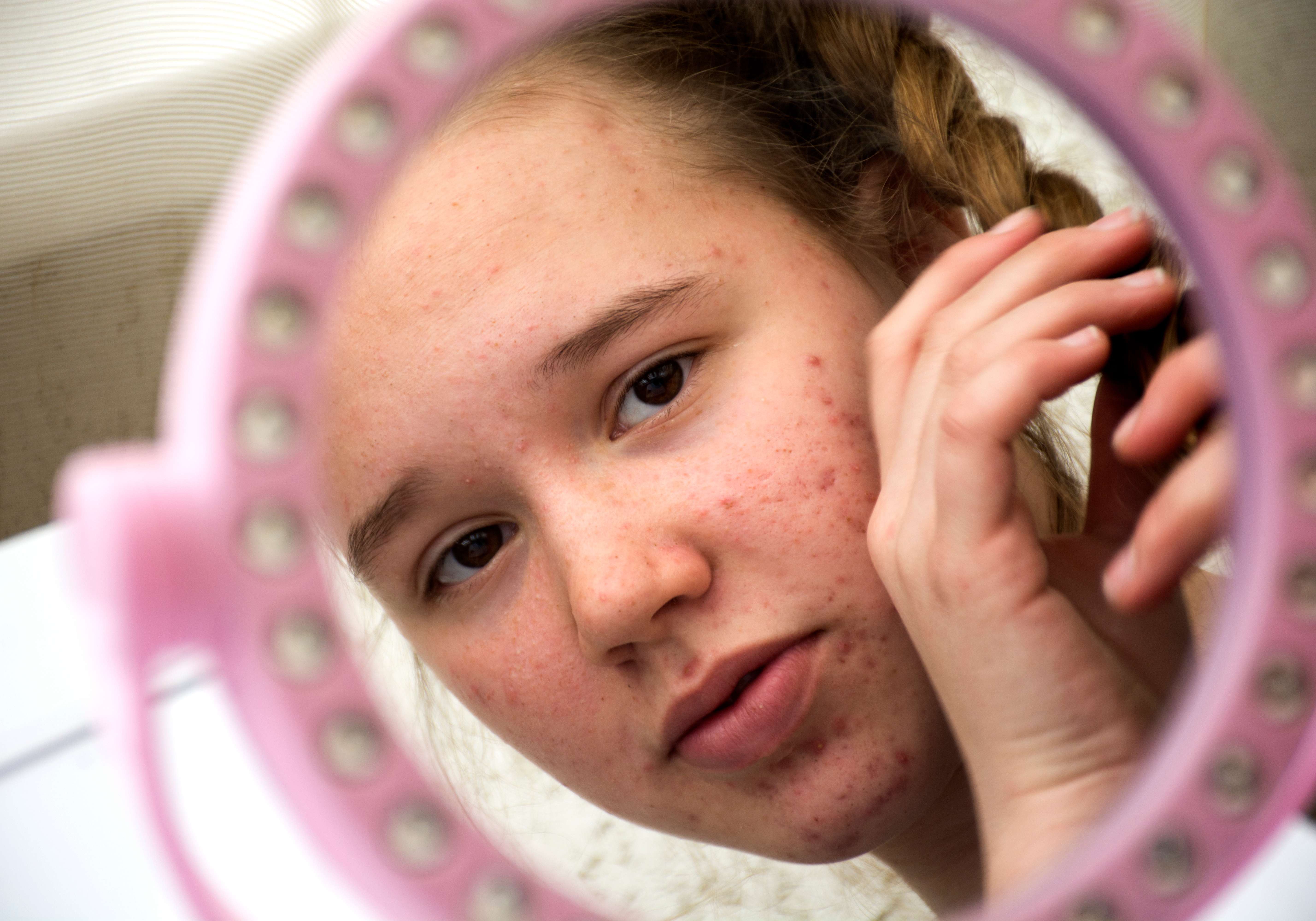 Ingyenes gyermekbőrgyógyászat – online